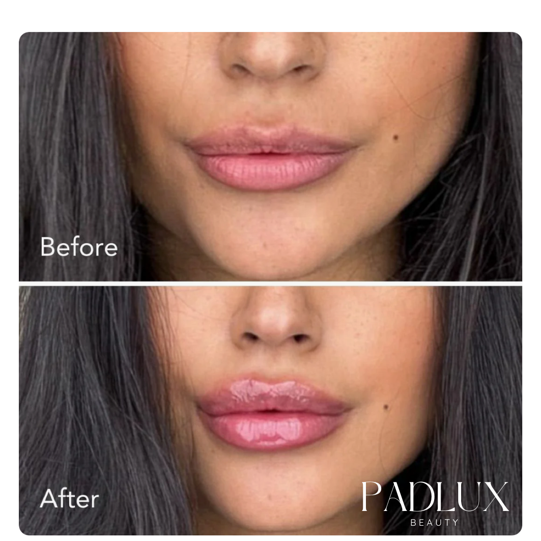 Padlux- Plump Kiss