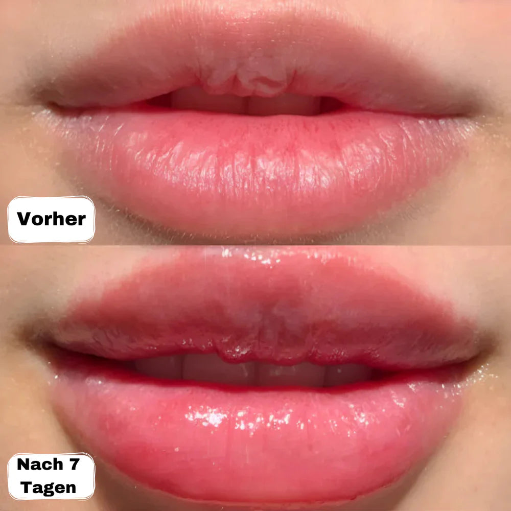 Padlux- Lip Booster Set